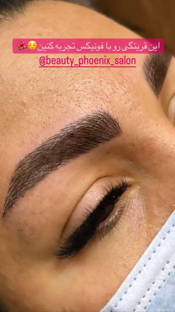 میکروبلیدینگ